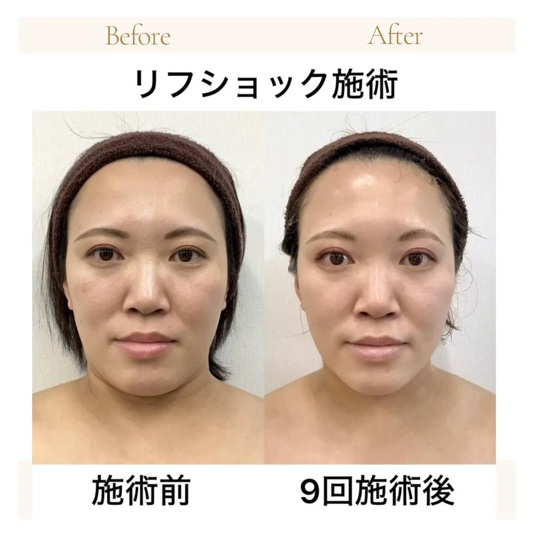 こんにちはサンスタイルクリア守山店です✨✨